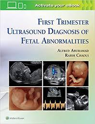 First Trimester Ultrasound Diagnosis of Fetal Abnormalities 1st Edition