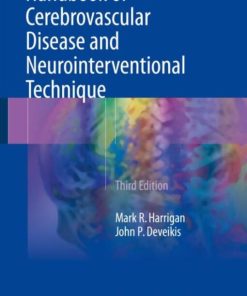 Handbook of Cerebrovascular Disease and Neurointerventional Technique (Contemporary Medical Imaging) 3rd