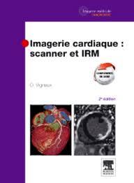 Imagerie cardiaque : scanner et IRM 2ème édition