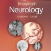 Imaging in Neurology