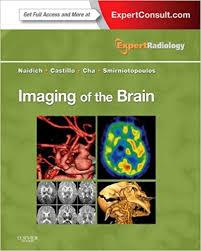 Imaging of the Brain: Expert Radiology Series, 1e