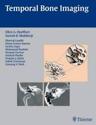 Imaging of the Temporal Bone, ed