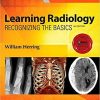 Learning Radiology: Recognizing the Basics