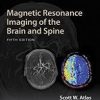 Magnetic Resonance Imaging of the Brain and Spine