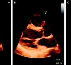 Mayo Clinic Echocardiography Board Review 2019 (CME VIDEOS)