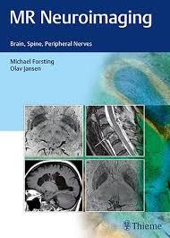 MR Neuroimaging: Brain, Spine, and Peripheral Nerves-Original PDF