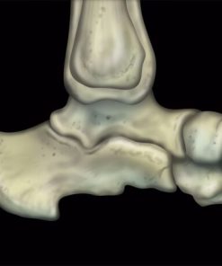 MRIOnline MRI Mastery Series: Ankle 2017 (CME VIDEOS)