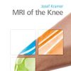 MRI of the Knee