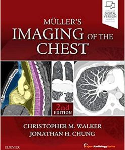 Muller’s Imaging of the Chest: Expert Radiology Series 2n