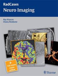 Neuro Imaging (RadCases)