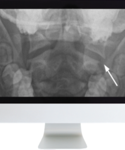 Neuroradiology Review for the Practicing Radiologist 2018 (ARRS VIDEOS) (CME VIDEOS)