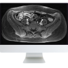 ARRS A Guide to Bowel Imaging 2019 (CME VIDEOS)