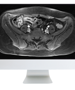 ARRS A Guide to Bowel Imaging 2019 (CME VIDEOS)