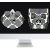 ARRS Cranial Nerve Imaging: From the Least to the Last 2022 ( Videos + CME Questions)