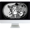 ARRS Gastrointestinal Imaging Online Course 2019 (CME VIDEOS)