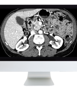 ARRS Gastrointestinal Imaging Online Course 2019 (CME VIDEOS)