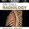 On Call Radiology