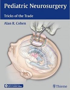 Pediatric Neurosurgery: Tricks of the Trade