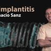 Peri-Implantitis: Prevention and Treatment (Video Course)