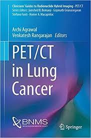 PET/CT in Lung Cancer (Clinicians’ Guides to Radionuclide Hybrid Imaging) 1st