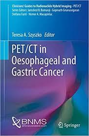 PET/CT in Oesophageal and Gastric Cancer (Clinicians’ Guides to Radionuclide Hybrid Imaging) 1st