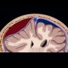 MRIOnline Emergency Series: Emergency Neuroimaging: Brain 2021 (CME VIDEOS)