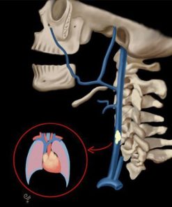 MRIOnline Emergency Series: Emergency Neuroimaging: Head, Neck & Spine 2021 (CME VIDEOS)