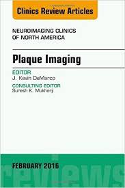 Plaque Imaging, An Issue of Neuroimaging Clinics of North America, 1e (The Clinics: Radiology)