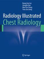 Radiology Illustrated: Chest Radiology