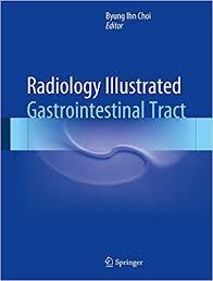 Radiology Illustrated Gastrointestinal Tract