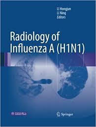 Radiology of Influenza A (H1N1)