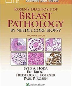 Rosen’s Diagnosis of Breast Pathology by Needle Core Biopsy, 4th Edition