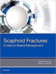 Scaphoid Fractures: Evidence-Based Management