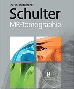 Schulter – MR-Tomographie