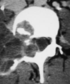 MRI Mastery Series: Degenerative Joint Disease (DJD) 2020 (CME VIDEOS)