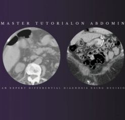 Federle’s Master Tutorial on Abdominal Imaging: How to Develop an Expert Differential Diagnosis using Decision-Support Tools 2021 (CME VIDEOS)