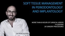 Soft Tissue Management in Periodontology and Implantology
