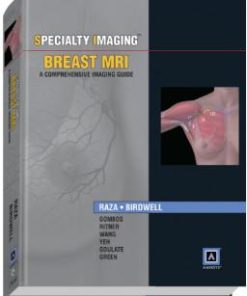 Specialty Imaging: Breast MRI: A Comprehensive Imaging Guide (Published by Amirsys®)