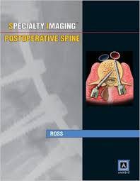 Specialty Imaging: Postoperative Spine: Published by Amirsys