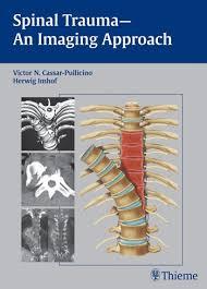 Spinal Trauma – An Imaging Approach