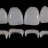 Gidedental Prosthetic Rehabilitation on Natural Teeth – Predictable, Esthetic and Systematic Steps 2020 (CME VIDEOS)