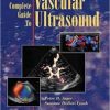 The Complete Guide to Vascular Ultrasound