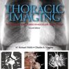 Thoracic Imaging: Pulmonary and Cardiovascular Radiology, 2nd Edition