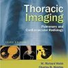 Thoracic Imaging: Pulmonary and Cardiovascular Radiology