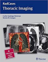 Thoracic Imaging (Radcases)