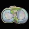 MRIOnline MRI Mastery Series: Knee 2021 (CME VIDEOS)