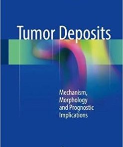 Tumor Deposits: Mechanism, Morphology and Prognostic Implications 1st