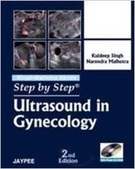 Ultrasound in Gynecology (Step By Step)