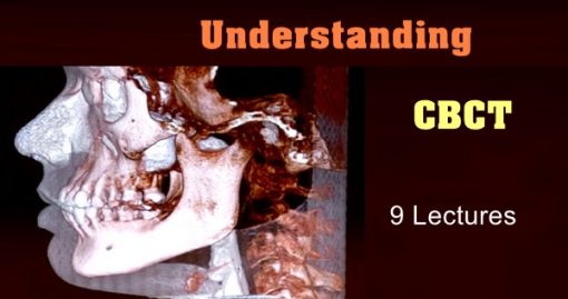Understanding CBCT video lectures