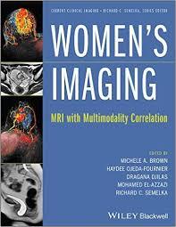 Women’s Imaging: MRI with Multimodality Correlation